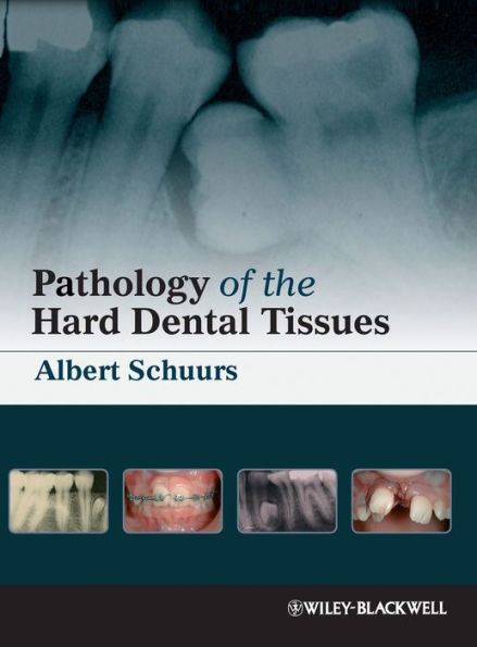 Pathology of the Hard Dental Tissues / Edition 1