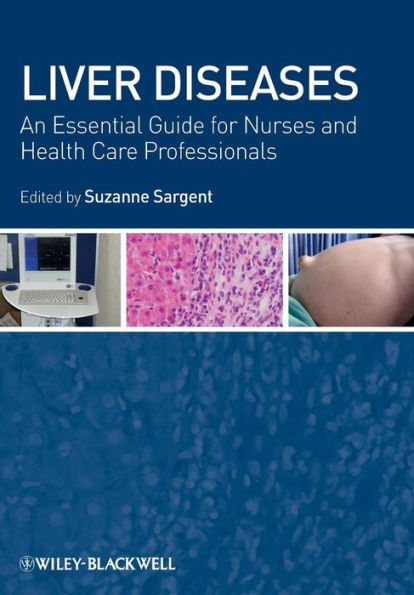 Liver Diseases: An Essential Guide for Nurses and Health Care Professionals / Edition 1