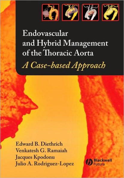 Endovascular and Hybrid Management of the Thoracic Aorta: A Case-based Approach / Edition 1