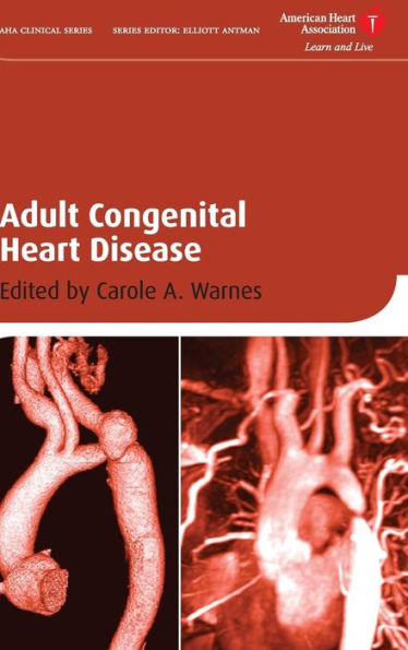 Adult Congenital Heart Disease / Edition 1