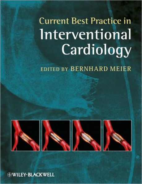 Current Best Practice in Interventional Cardiology / Edition 1