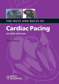 Title: The Nuts and Bolts of Cardiac Pacing / Edition 2, Author: Tom Kenny