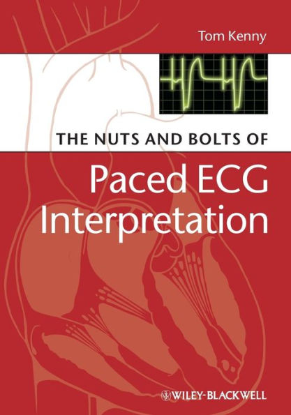 The Nuts and bolts of Paced ECG Interpretation / Edition 1