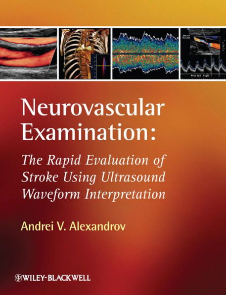 Neurovascular Examination: The Rapid Evaluation of Stroke Patients Using Ultrasound Waveform Interpretation / Edition 1