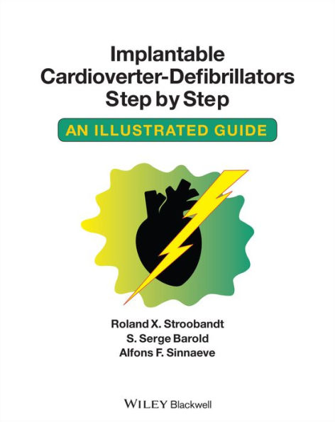 Implantable Cardioverter - Defibrillators Step by Step: An Illustrated Guide / Edition 1