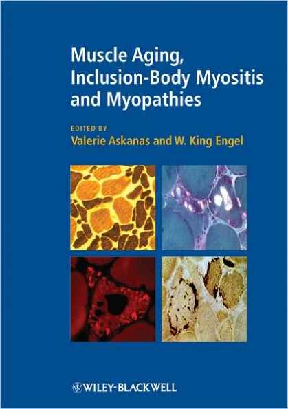 Muscle Aging, Inclusion-Body Myositis and Myopathies / Edition 1