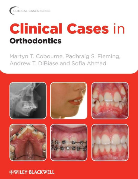 Clinical Cases in Orthodontics / Edition 1