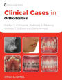 Clinical Cases in Orthodontics / Edition 1