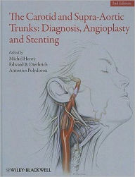Title: The Carotid and Supra-Aortic Trunks: Diagnosis, Angioplasty and Stenting / Edition 1, Author: Michel Henry