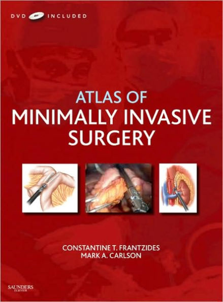 Atlas of Minimally Invasive Surgery with DVD