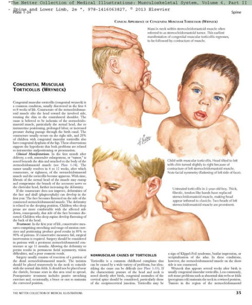 The Netter Collection of Medical Illustrations: Musculoskeletal