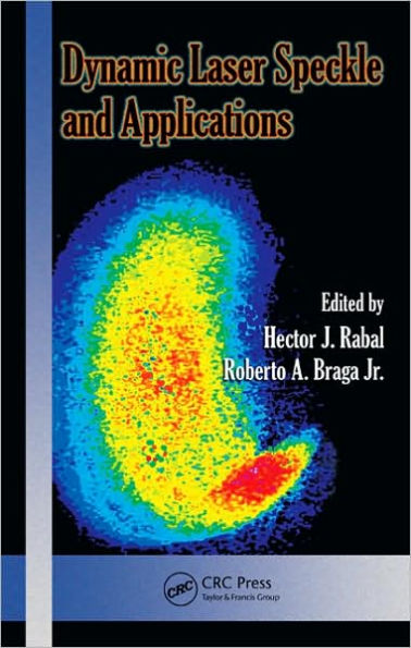 Dynamic Laser Speckle and Applications