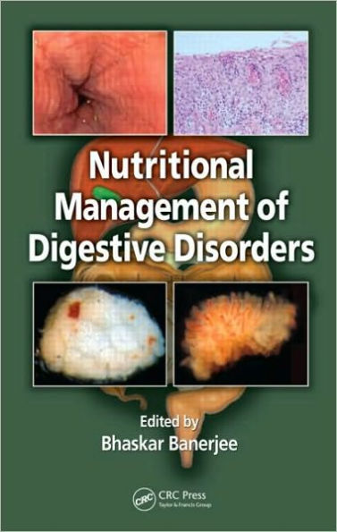 Nutritional Management of Digestive Disorders / Edition 1