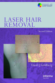 Title: Laser Hair Removal, Author: David J. Goldberg