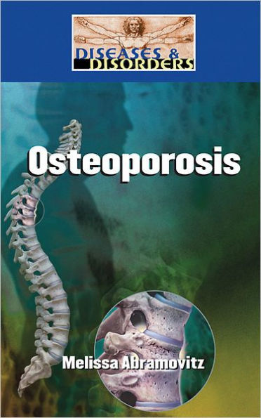 Osteoporosis / Edition 1