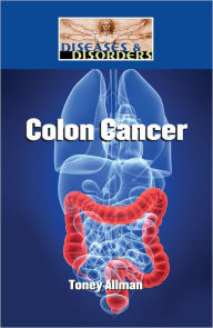 Title: Colon Cancer, Author: Toney Allman