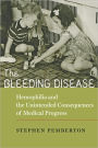 The Bleeding Disease: Hemophilia and the Unintended Consequences of Medical Progress