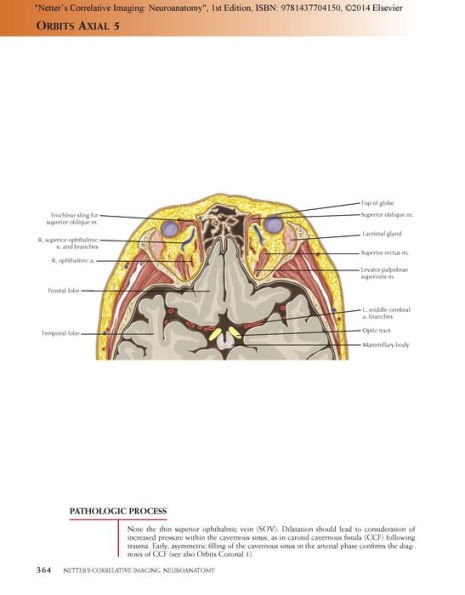 Netter's Correlative Imaging: Neuroanatomy: with NetterReference.com Access