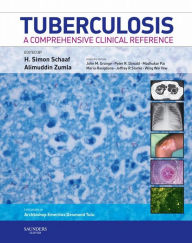 Title: Tuberculosis E-Book: A Comprehensive Clinical Reference, Author: H. Simon Schaaf