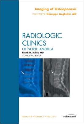 Imaging Of Osteoporosis An Issue Of Radiologic Clinics Of North Americahardcover - 