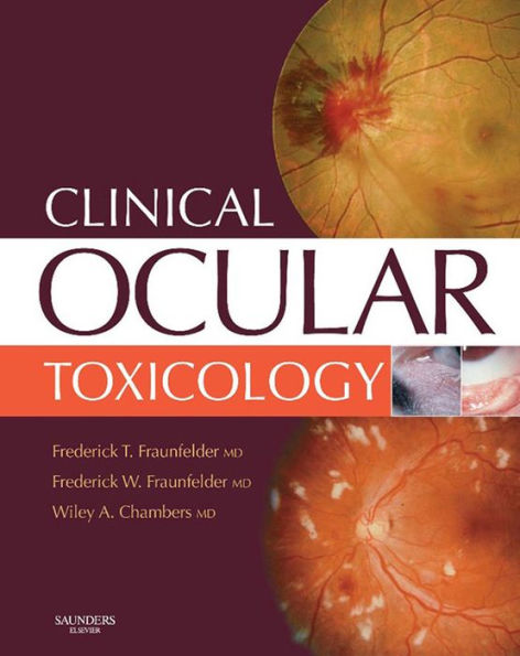 Clinical Ocular Toxicology E-Book: Drug-Induced Ocular Side Effects