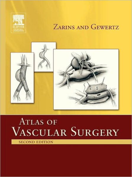 Atlas Of Vascular Surgery - Paperback Edition / Edition 2