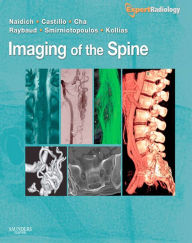 Title: Imaging of the Spine E-Book: Expert Radiology Series, Author: Thomas P. Naidich MD