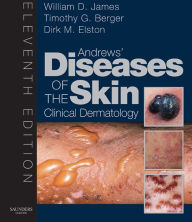 Title: Andrew's Diseases of the Skin E-Book: Clinical Dermatology, Author: William D. James