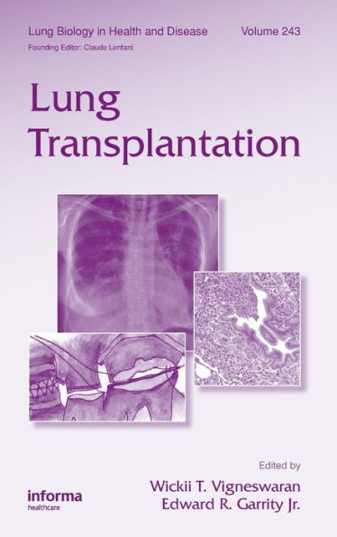 Lung Transplantation / Edition 1