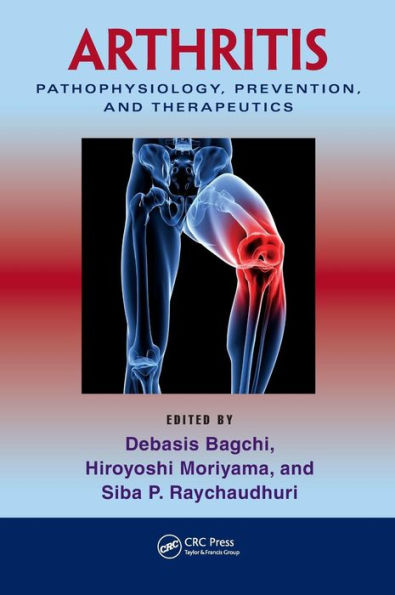 Arthritis: Pathophysiology, Prevention, and Therapeutics