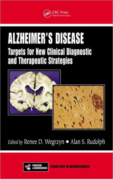 Alzheimer's Disease: Targets for New Clinical Diagnostic and Therapeutic Strategies / Edition 1