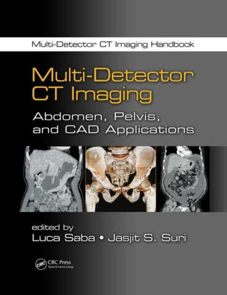 Multi-Detector CT Imaging: Abdomen, Pelvis, and CAD Applications / Edition 1