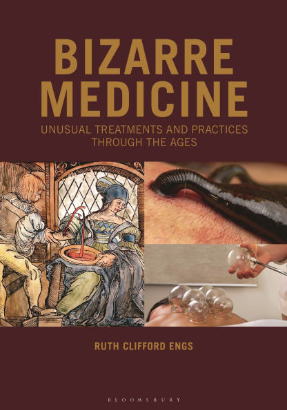 Bizarre Medicine: Unusual Treatments and Practices through the Ages