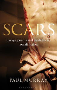 Title: Scars: Essays, Poems and Meditations on Affliction, Author: Paul Murray OP