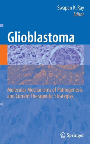 Glioblastoma:: Molecular Mechanisms of Pathogenesis and Current Therapeutic Strategies / Edition 1