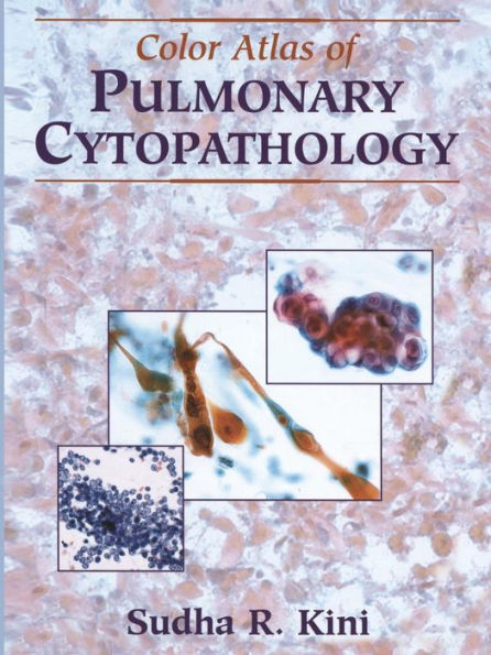 Color Atlas of Pulmonary Cytopathology