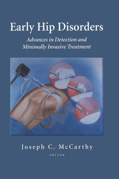 Early Hip Disorders: Advances in Detection and Minimally Invasive Treatment / Edition 1