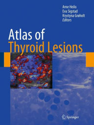 Title: Atlas of Thyroid Lesions / Edition 1, Author: Arne Heilo