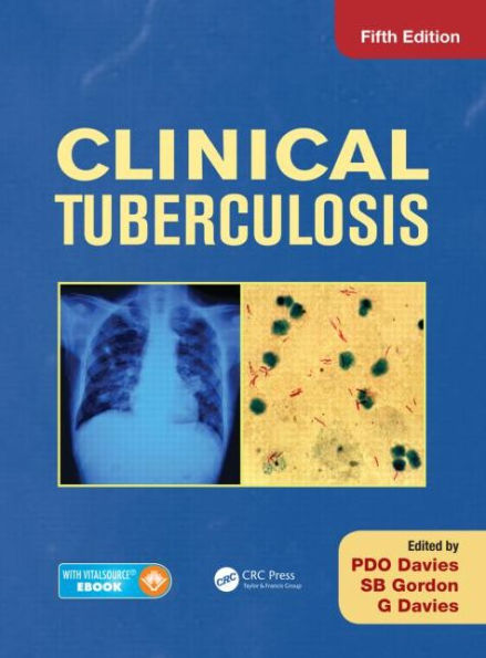 Clinical Tuberculosis / Edition 5