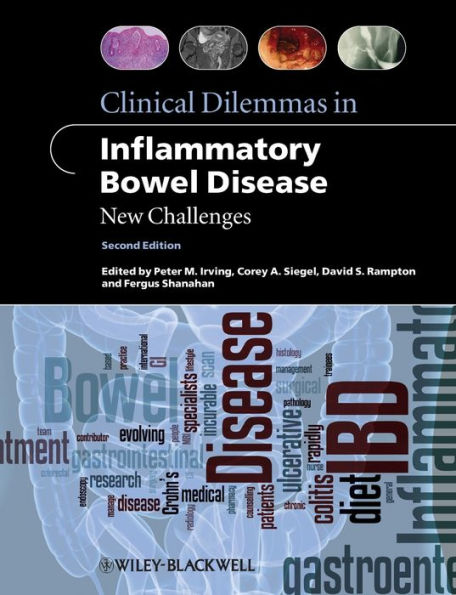 Clinical Dilemmas in Inflammatory Bowel Disease: New Challenges / Edition 2