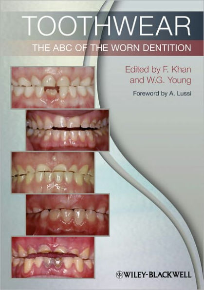 Toothwear: The ABC of the Worn Dentition / Edition 1