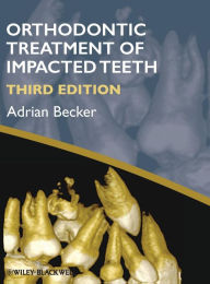 Title: Orthodontic Treatment of Impacted Teeth / Edition 3, Author: Adrian Becker