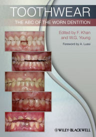 Title: Toothwear: The ABC of the Worn Dentition, Author: Farid Khan