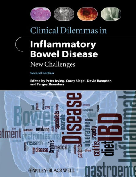 Clinical Dilemmas in Inflammatory Bowel Disease: New Challenges