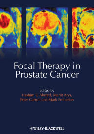 Title: Focal Therapy in Prostate Cancer, Author: Hashim Uddin Ahmed