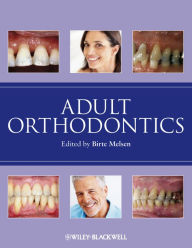 Title: Adult Orthodontics, Author: Birte Melsen