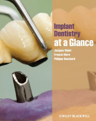 Title: Implant Dentistry at a Glance, Author: Jacques Malet