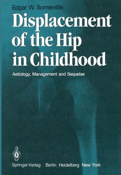 Displacement of the Hip in Childhood: Aetiology, Management and Sequelae