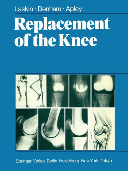 Replacement of the Knee