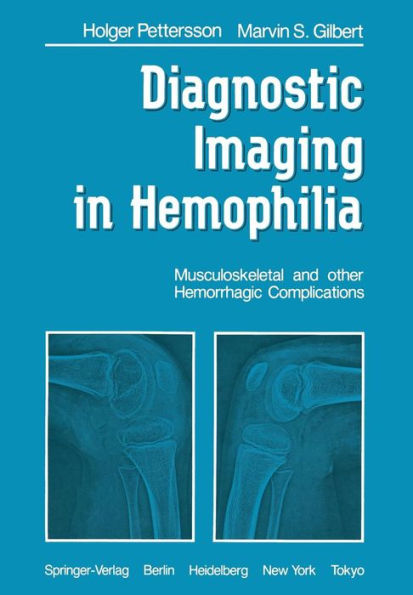 Diagnostic Imaging in Hemophilia: Musculoskeletal and Other Hemorrhagic Complications